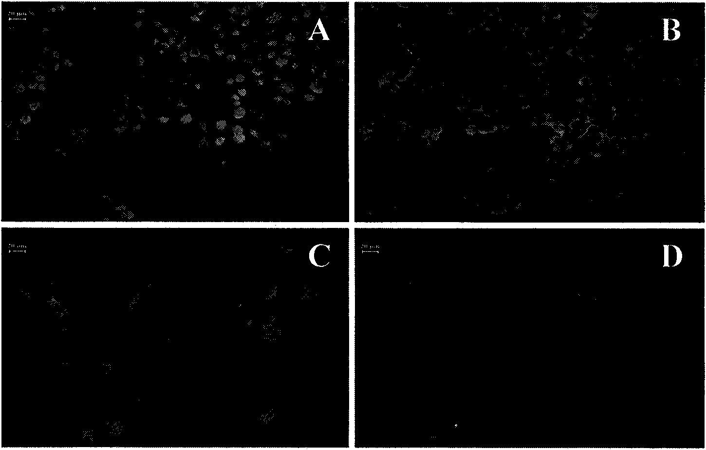 Tissue engineered artificial optic nerve conduit and preparation method thereof