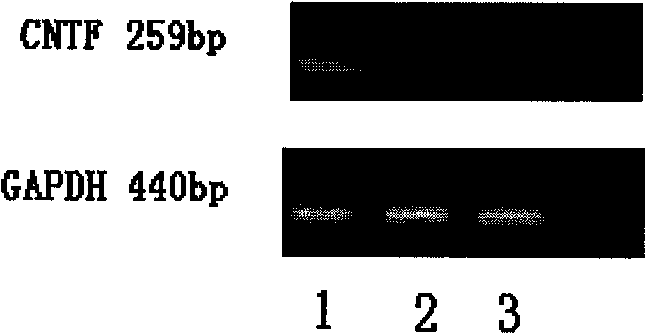 Tissue engineered artificial optic nerve conduit and preparation method thereof