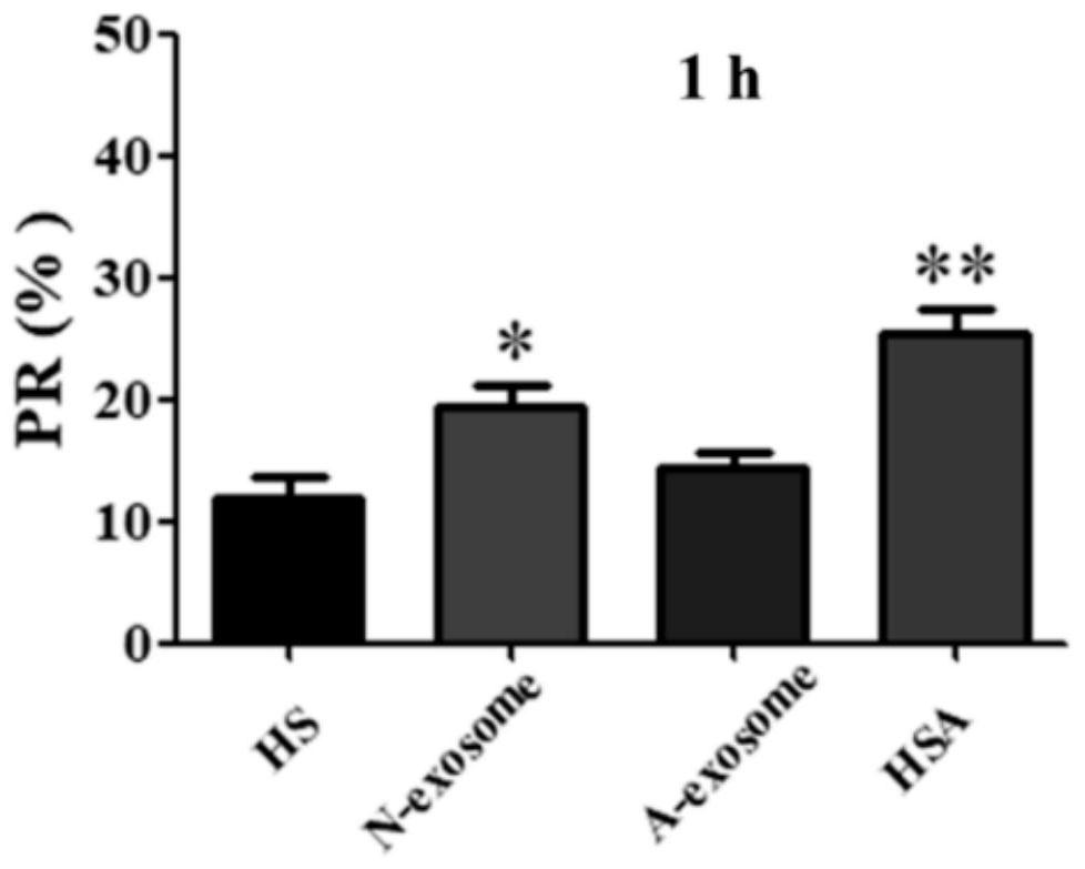 Method for improving sperm function of asthenozoospermia by using exosomes