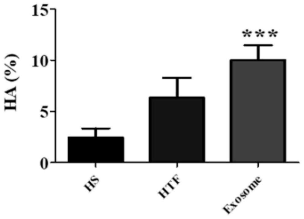 Method for improving sperm function of asthenozoospermia by using exosomes