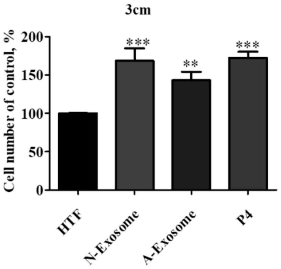 Method for improving sperm function of asthenozoospermia by using exosomes