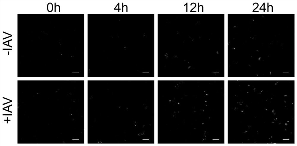 Influenza A virus nucleic acid labeling method based on rare earth up-conversion nanoprobe