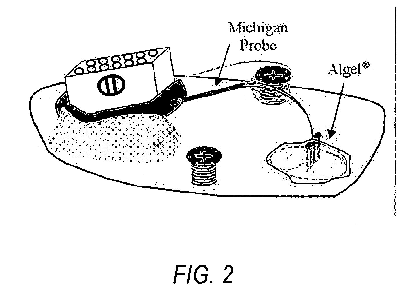 Compositions and methods for use of alginate dural sealants