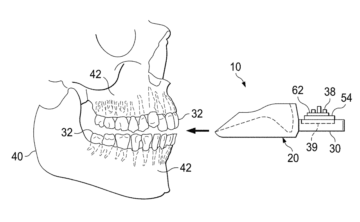 Pulsatile orthodontic device and methods