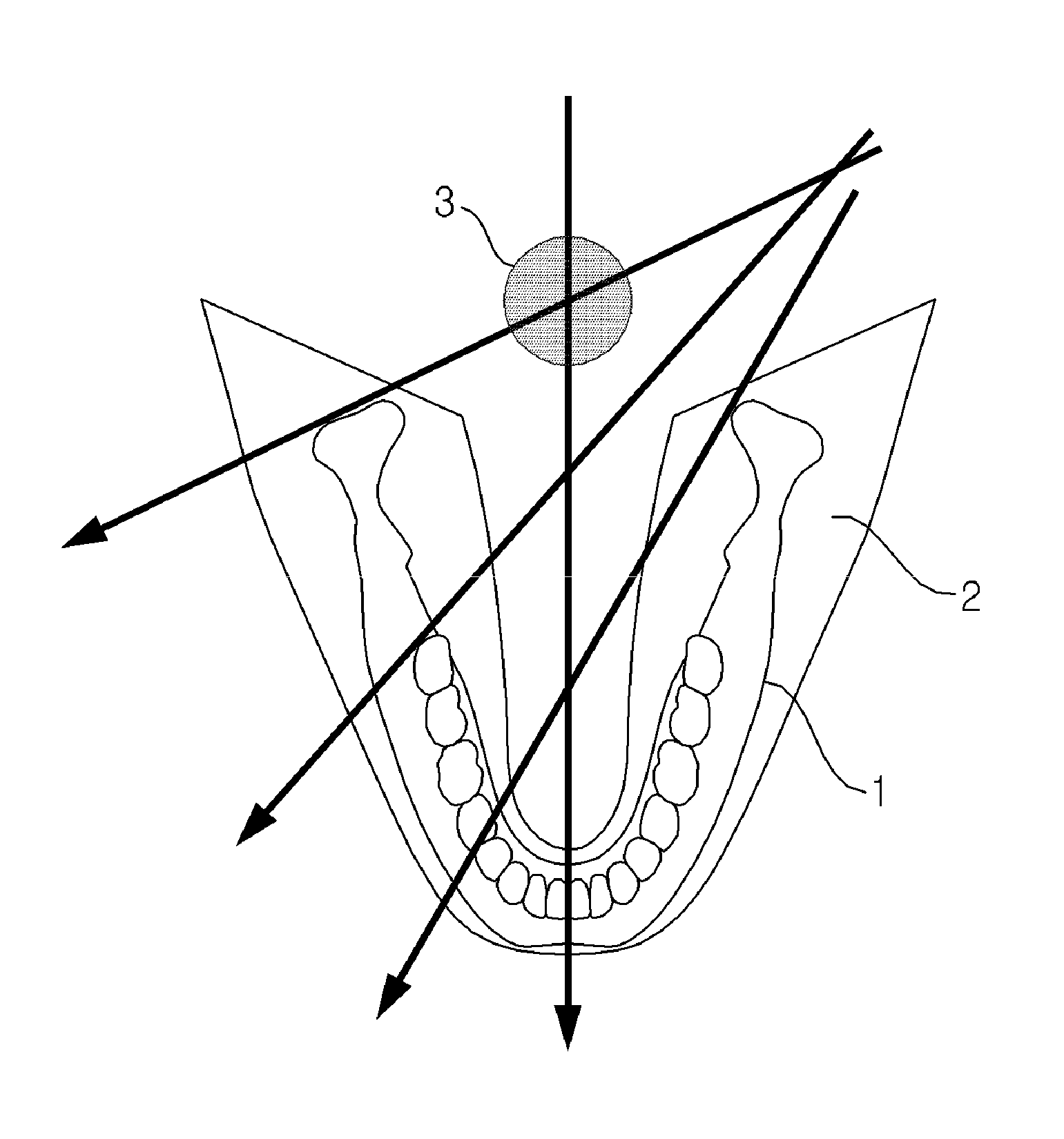 Method and apparatus for obtaining panoramic images