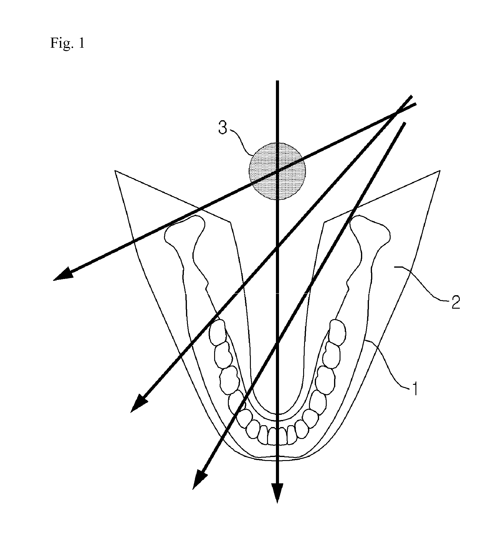 Method and apparatus for obtaining panoramic images