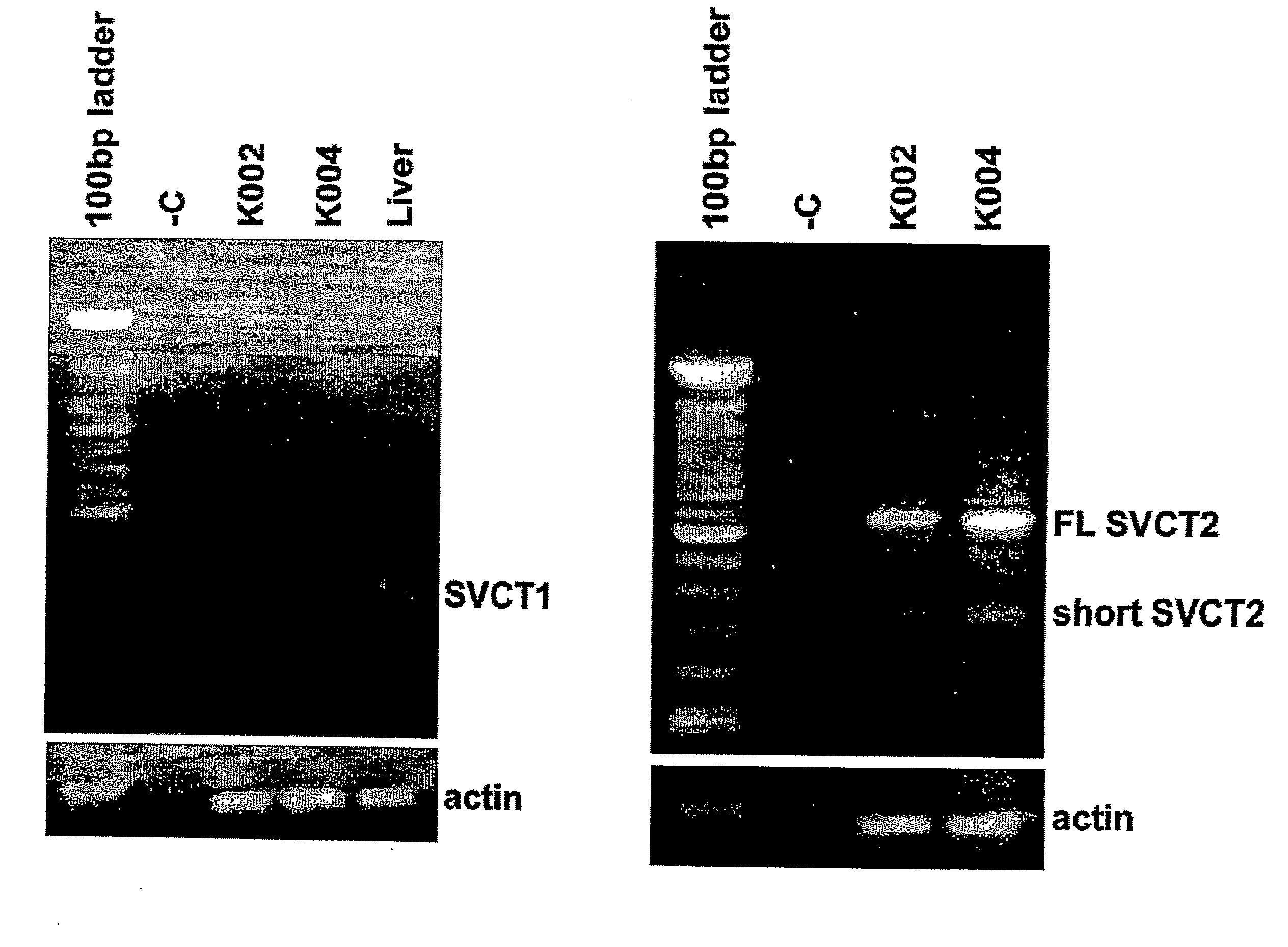 Facilitated Transport of Bisphosphonates by Vitamin C