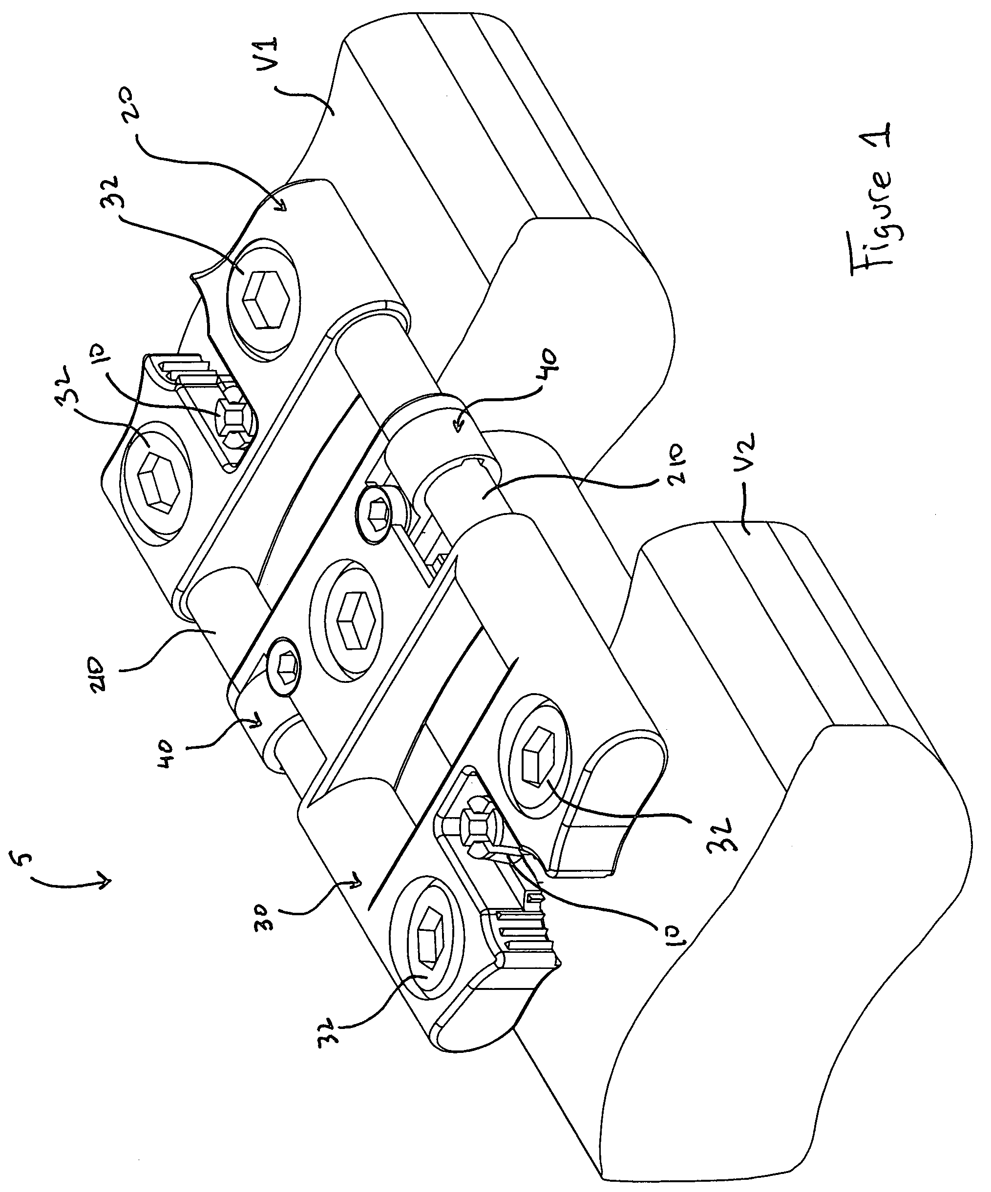 Bone fixation system and method of implantation