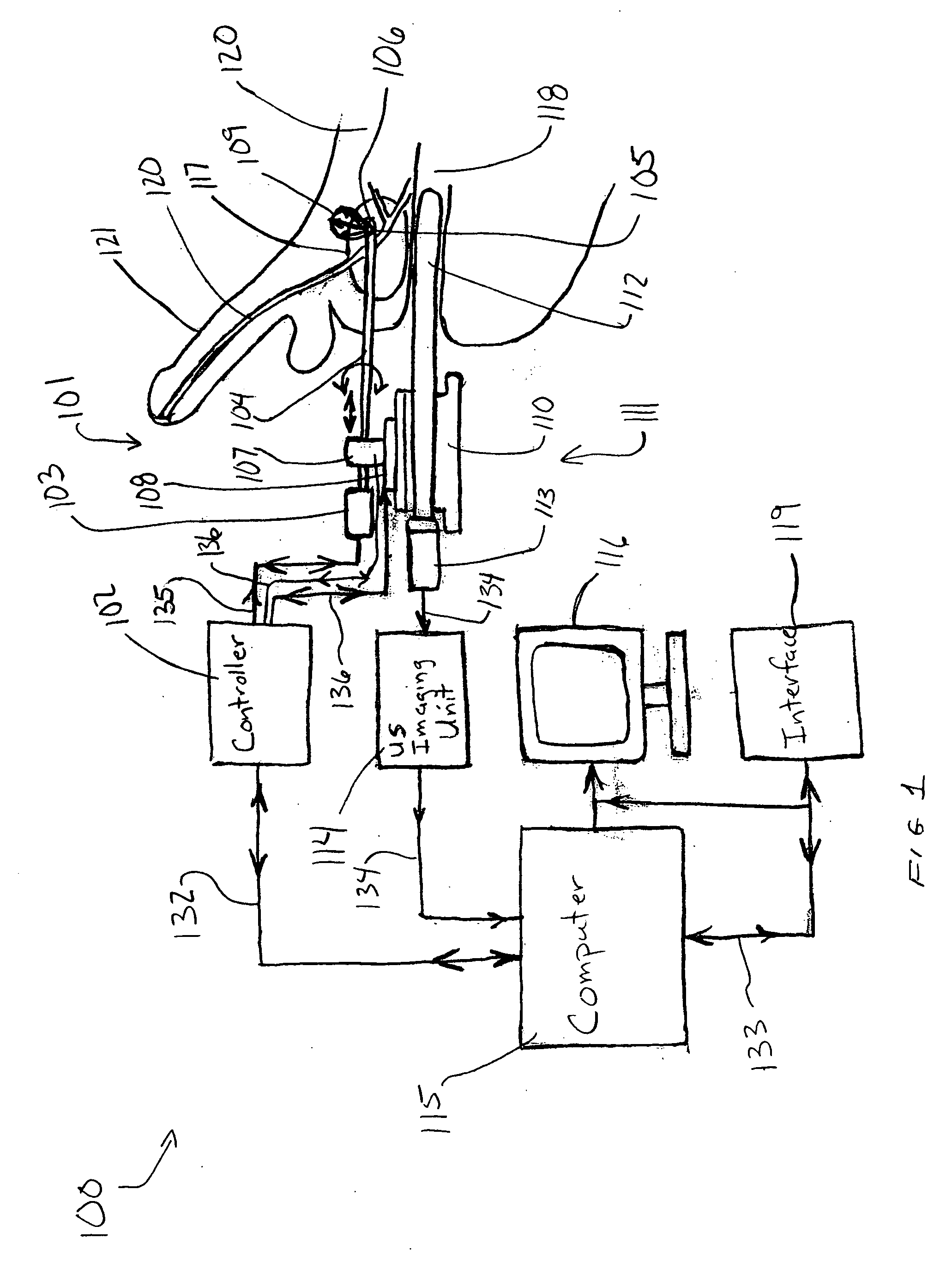 Apparatus and method for conformal radiation brachytherapy for prostate gland and other tumors