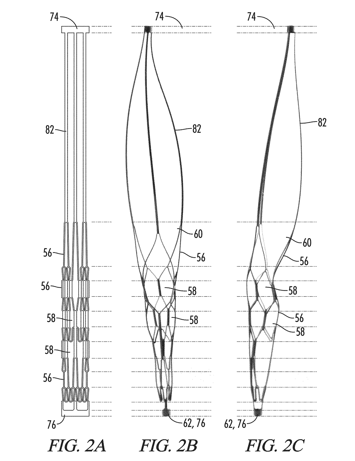 Clot retrieval system