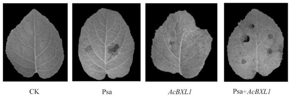 Kiwi fruit canker susceptible gene AcBXL1 and application thereof