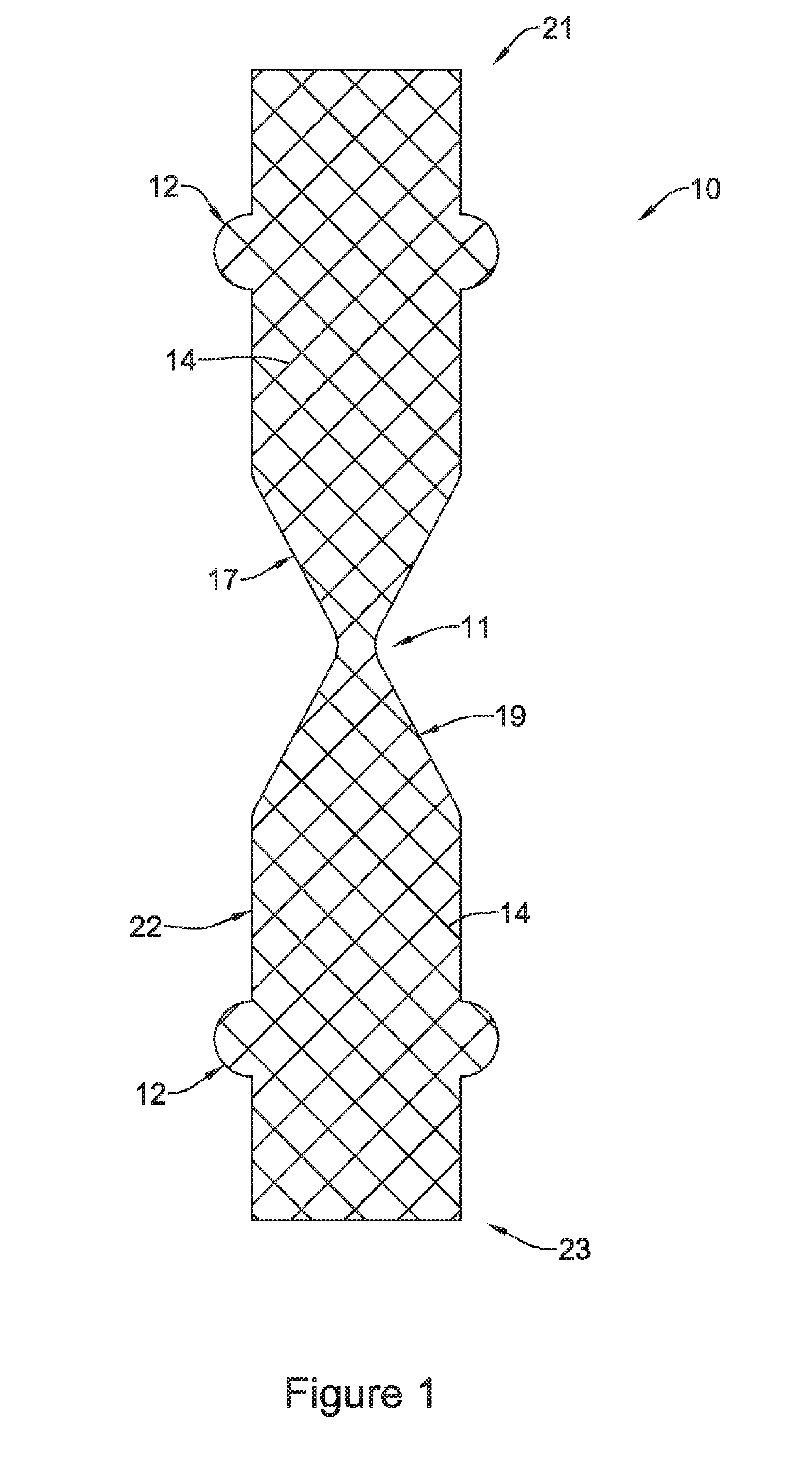 Esophageal stent including a valve member