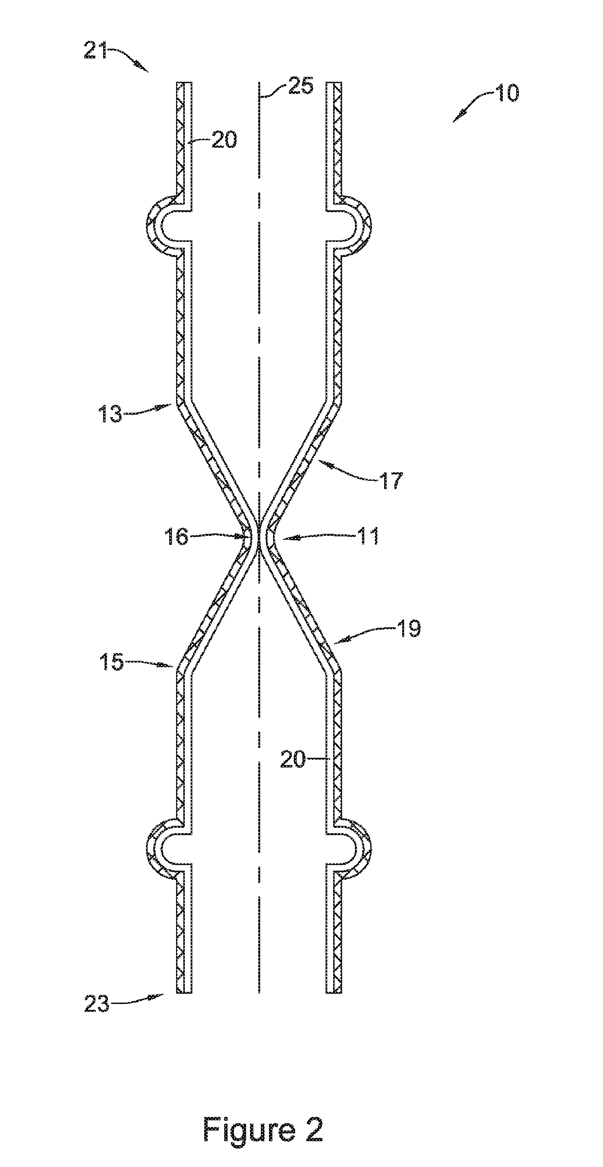 Esophageal stent including a valve member