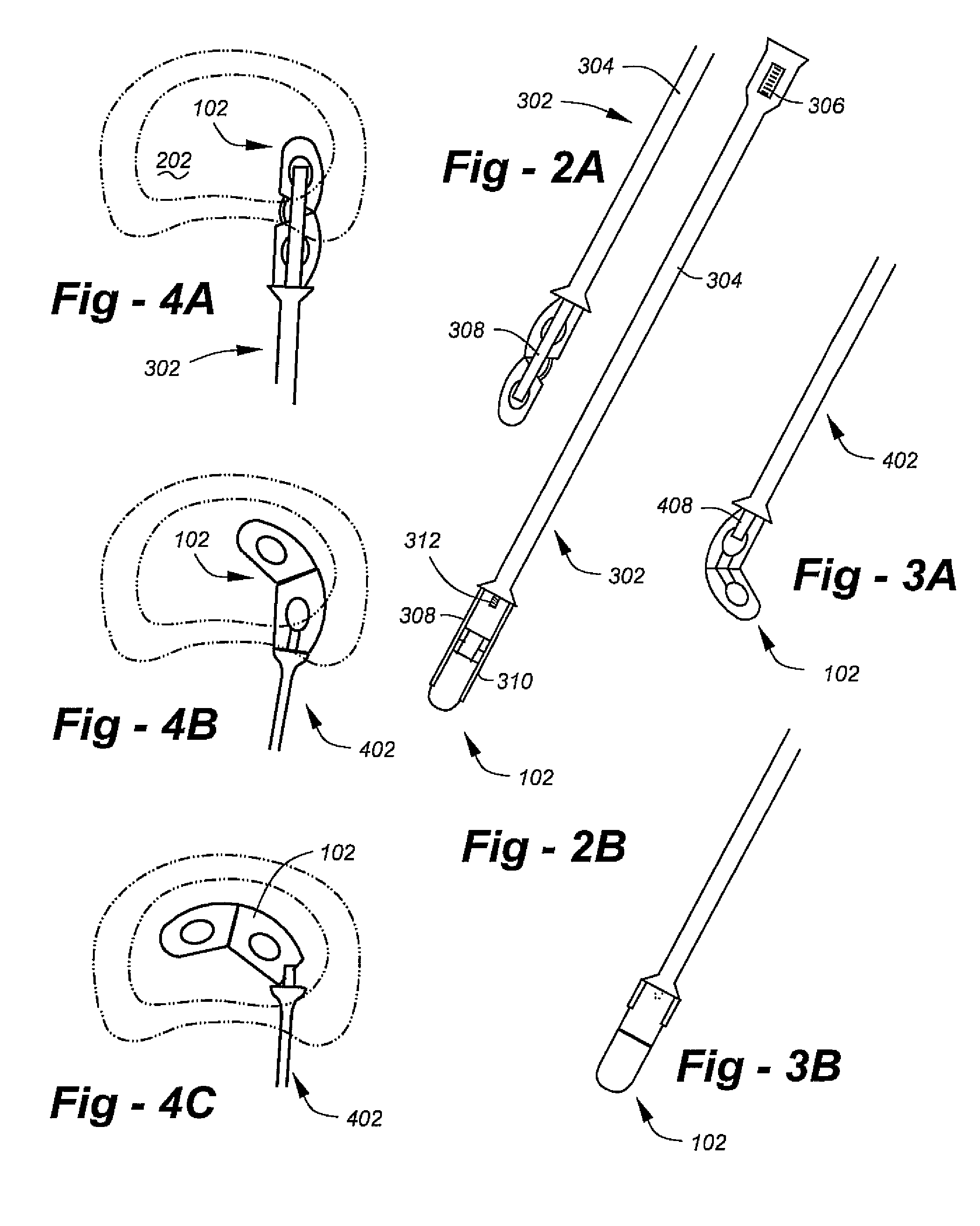 Steerable interbody fusion cage