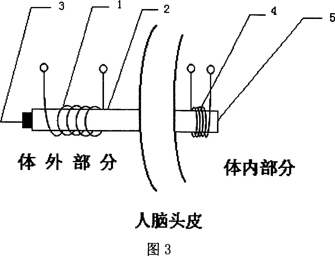 Class D amplifier driven external deep brain stimulator