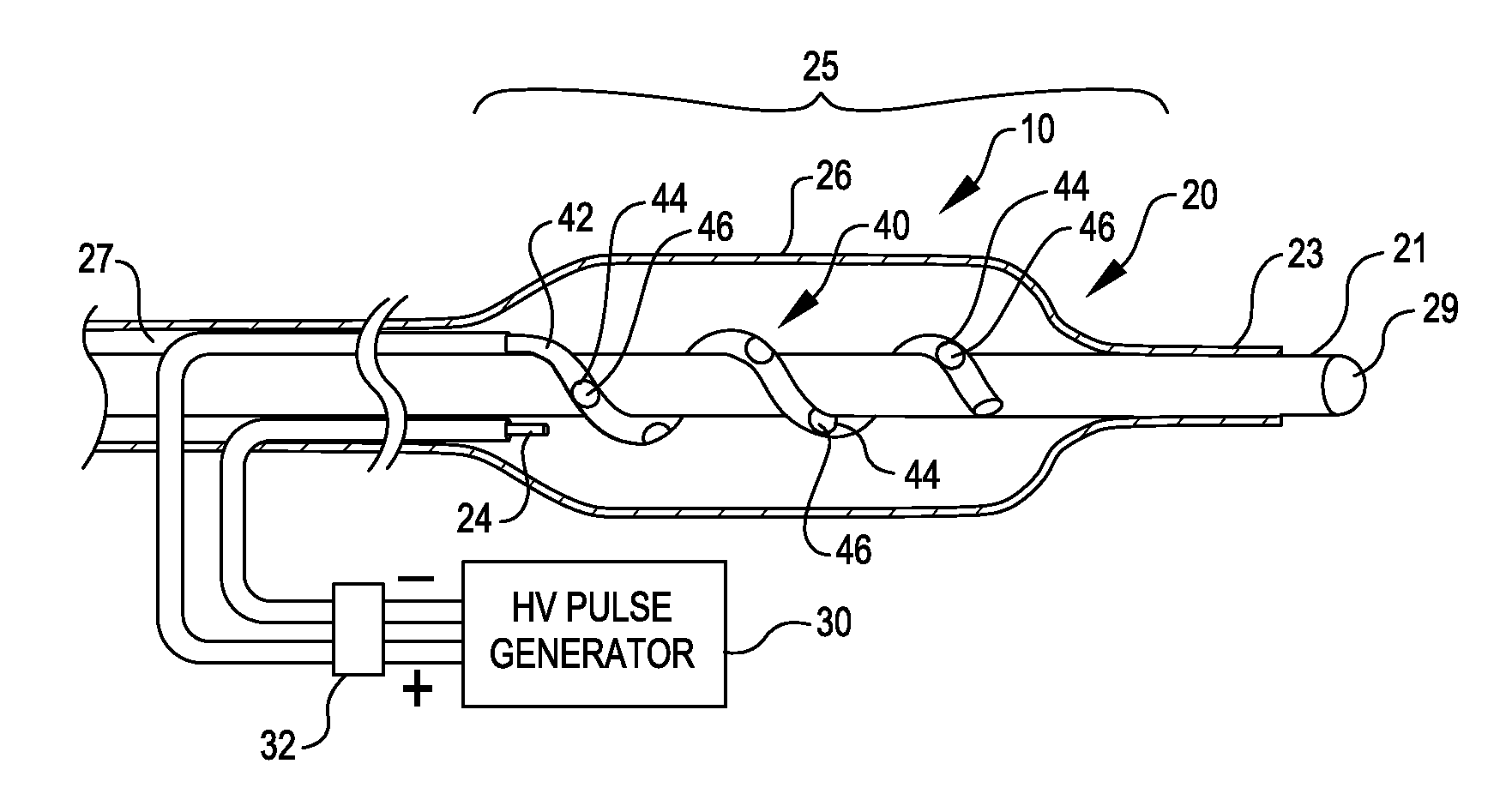 Shock wave balloon catheter with multiple shock wave sources