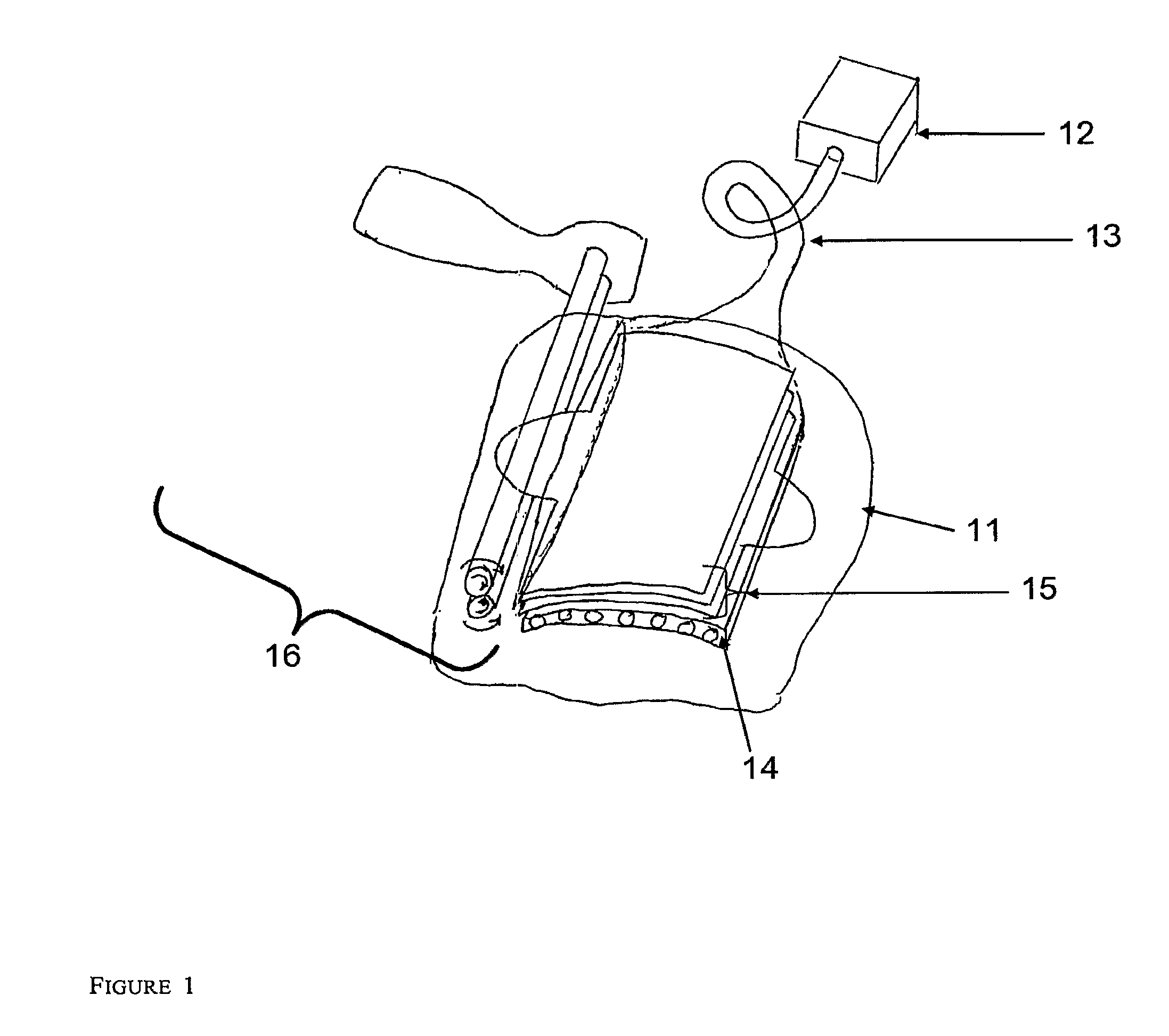 Diagnostic system for the detection of skin cancer