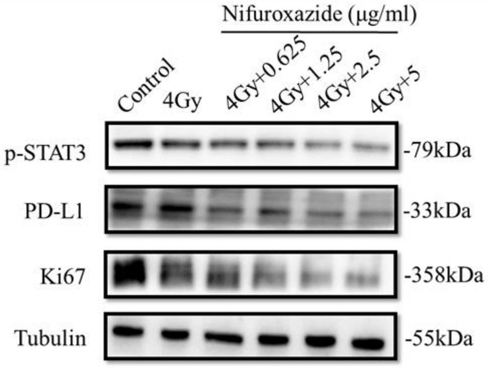 Application of Nifuroxazide in preparation of medicine for treating hepatocellular carcinoma