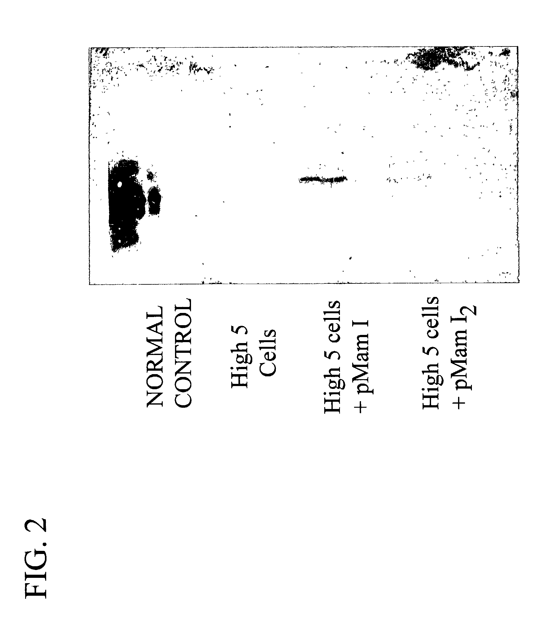 Methods for treating breast cancer using a mammary cell growth inhibitor