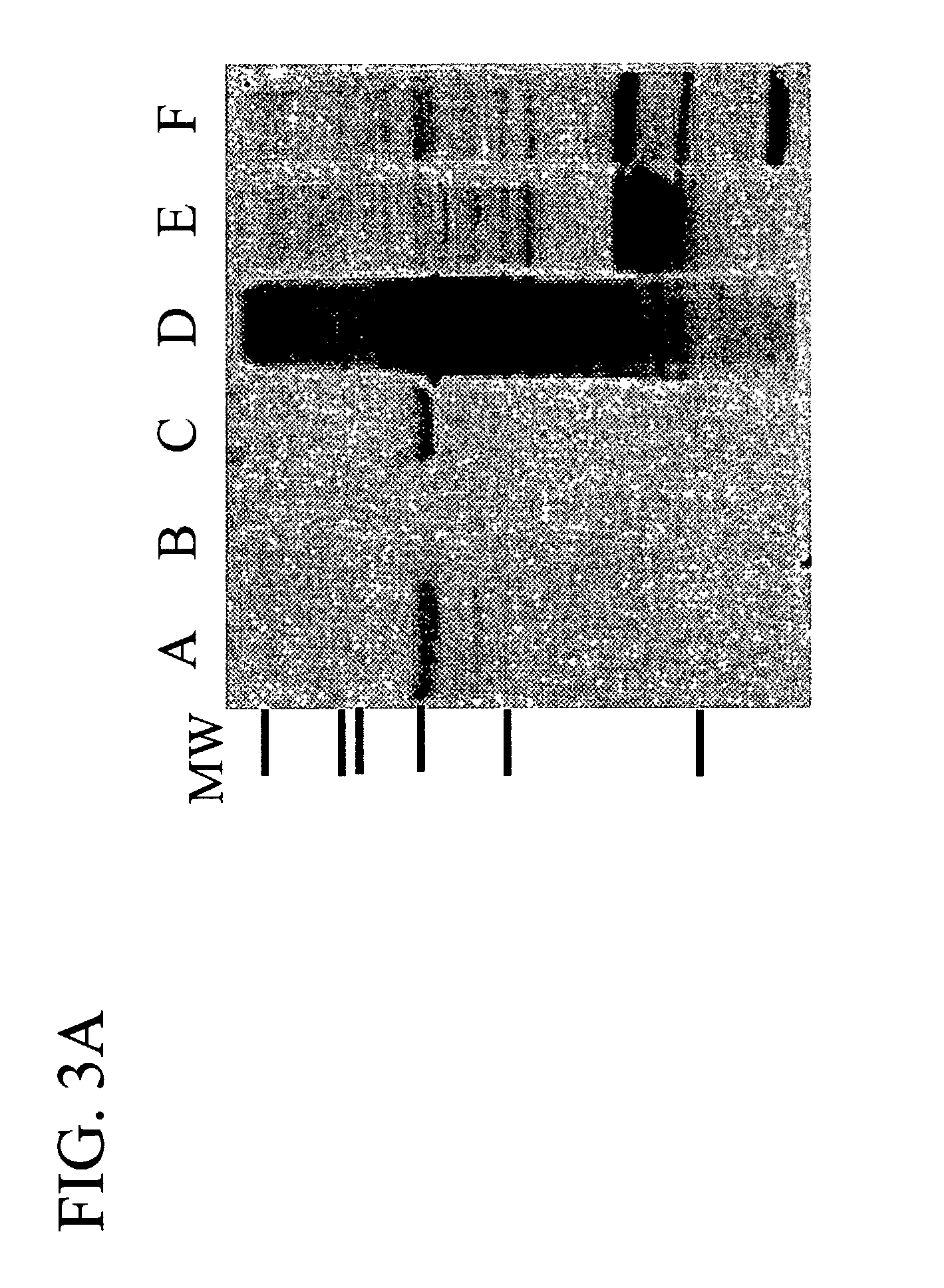 Methods for treating breast cancer using a mammary cell growth inhibitor