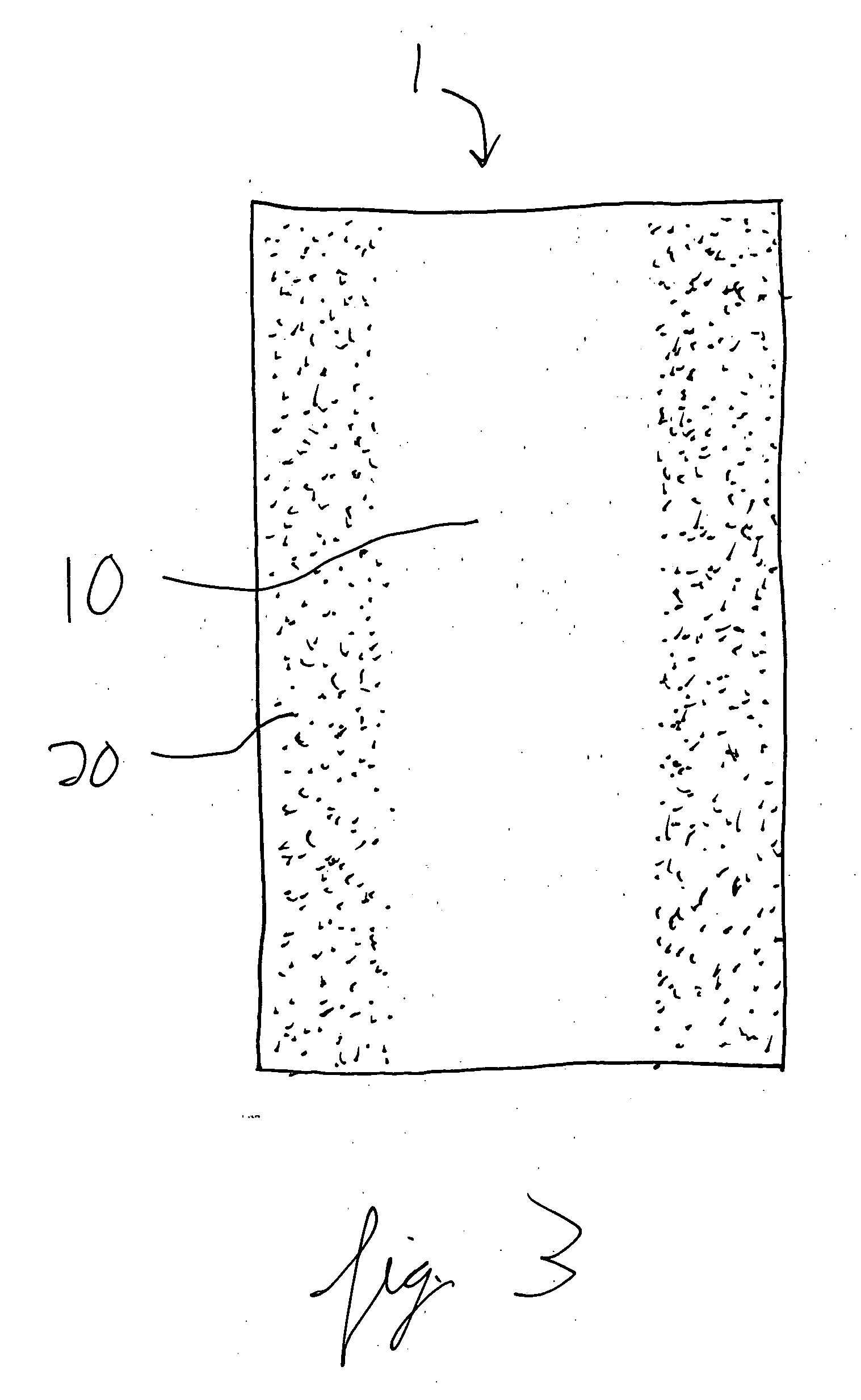 Adhesive-containing wound closure device and method