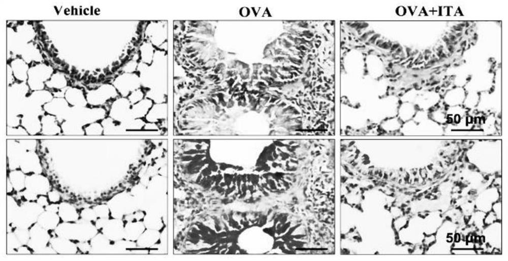 Application of itaconic acid in preparation of medicine for treating or relieving allergic airway inflammation diseases