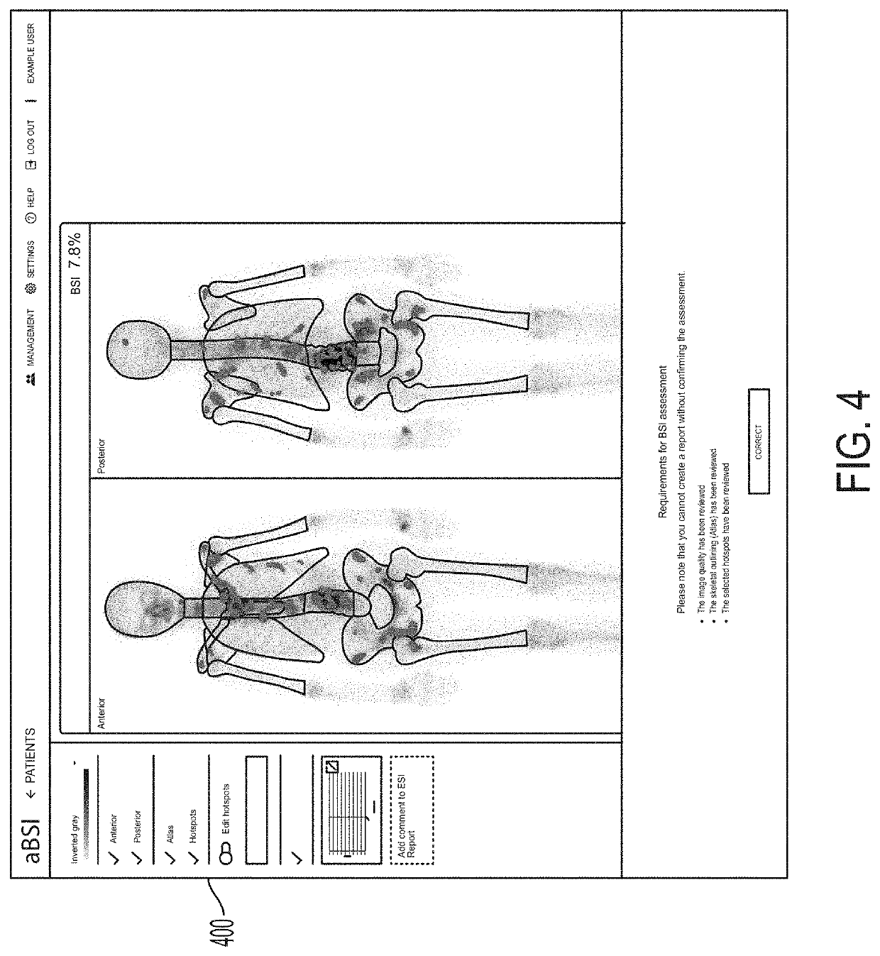 Systems and methods for automated and interactive analysis of bone scan images for detection of metastases