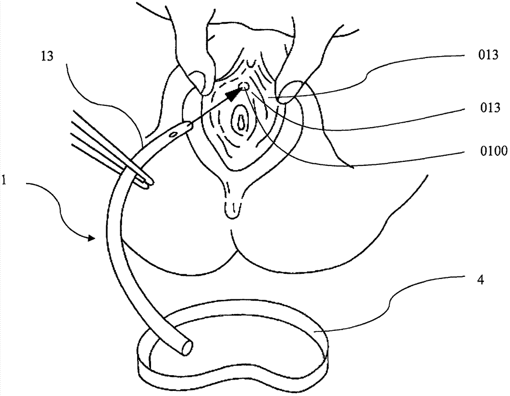 Female-only catheter