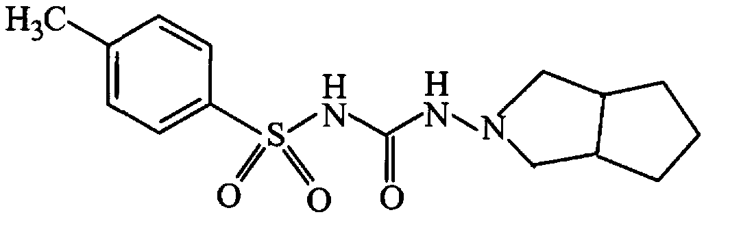 Gliclazide tablet and preparation method thereof