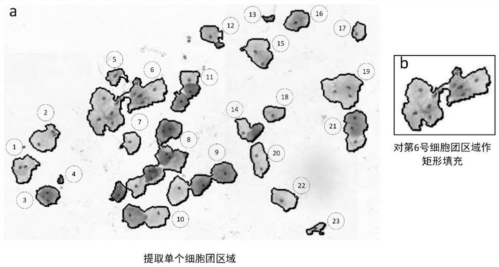 Method and system for identifying lesion cells in cervical cytopathological slices based on cell clusters