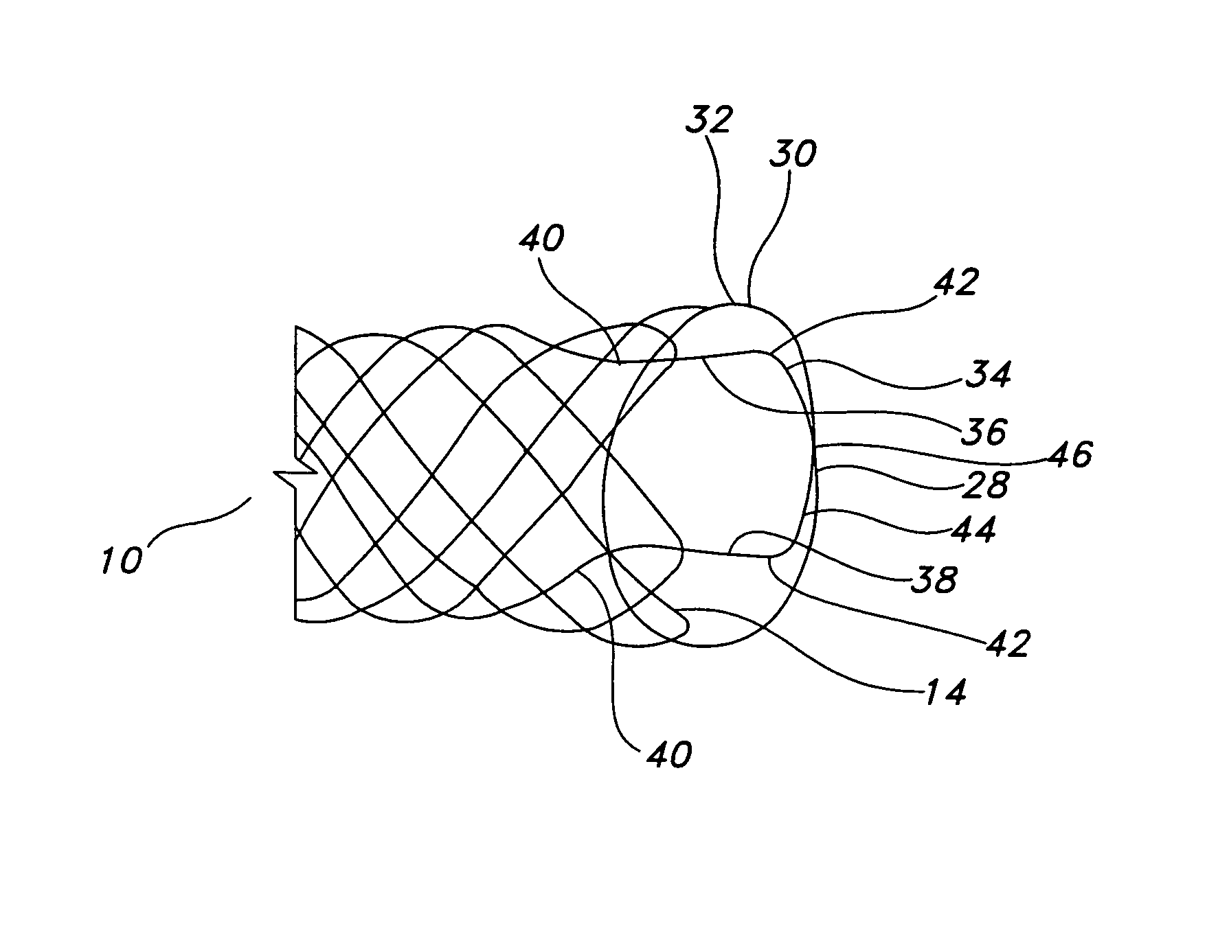 Integrated stent repositioning and retrieval loop