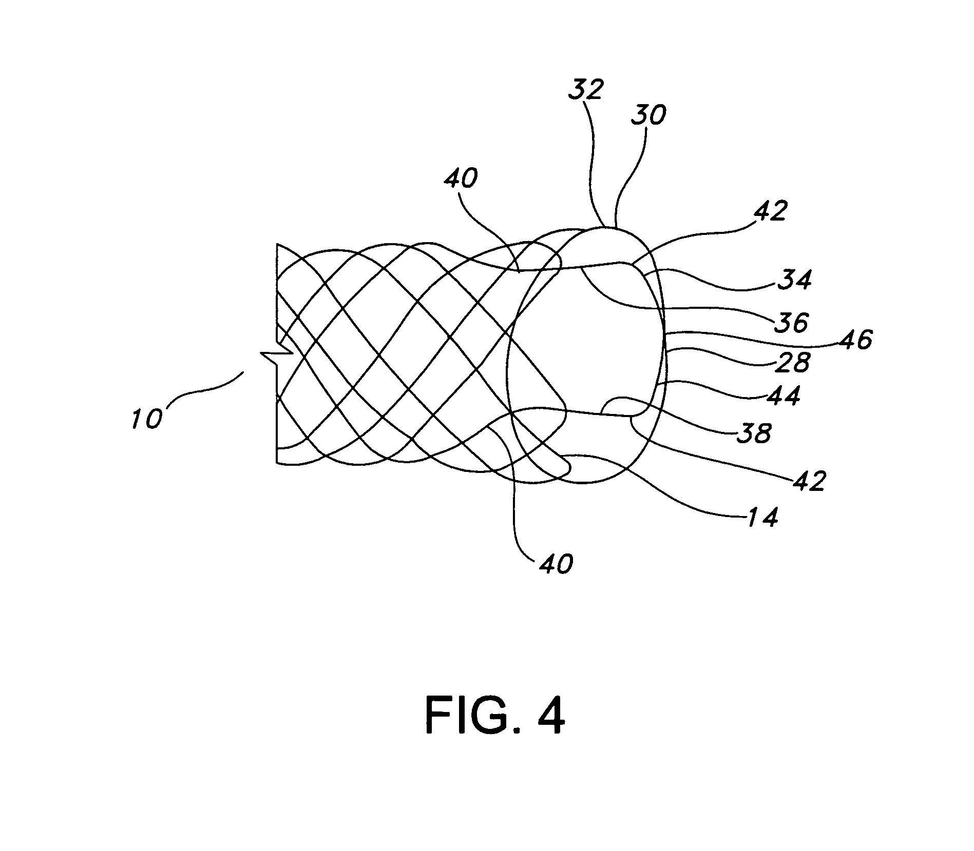 Integrated stent repositioning and retrieval loop