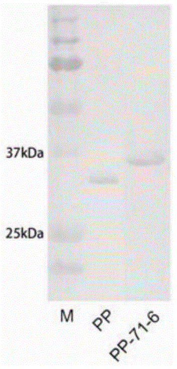 Enterovirus 71 type epitope as well as antibody and application and vaccine thereof