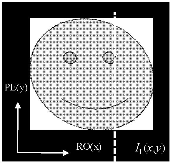 Method and system for correcting image distortion and magnetic resonance imaging device