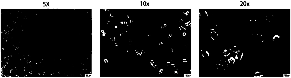 Chinese pancreas cancer cell line sipanc-187 establishment method