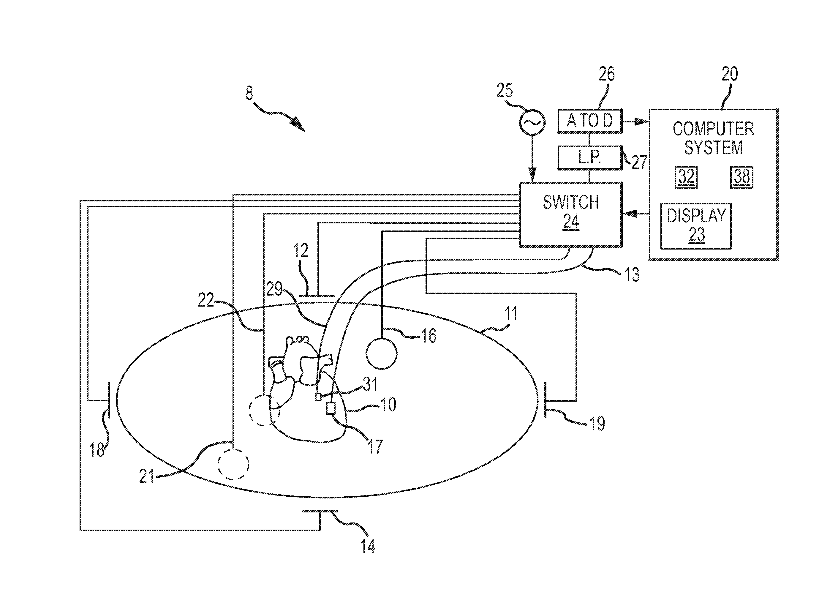 Cardiac Mapping System And Method For Bi-Directional Activation Detection Of Electrograms