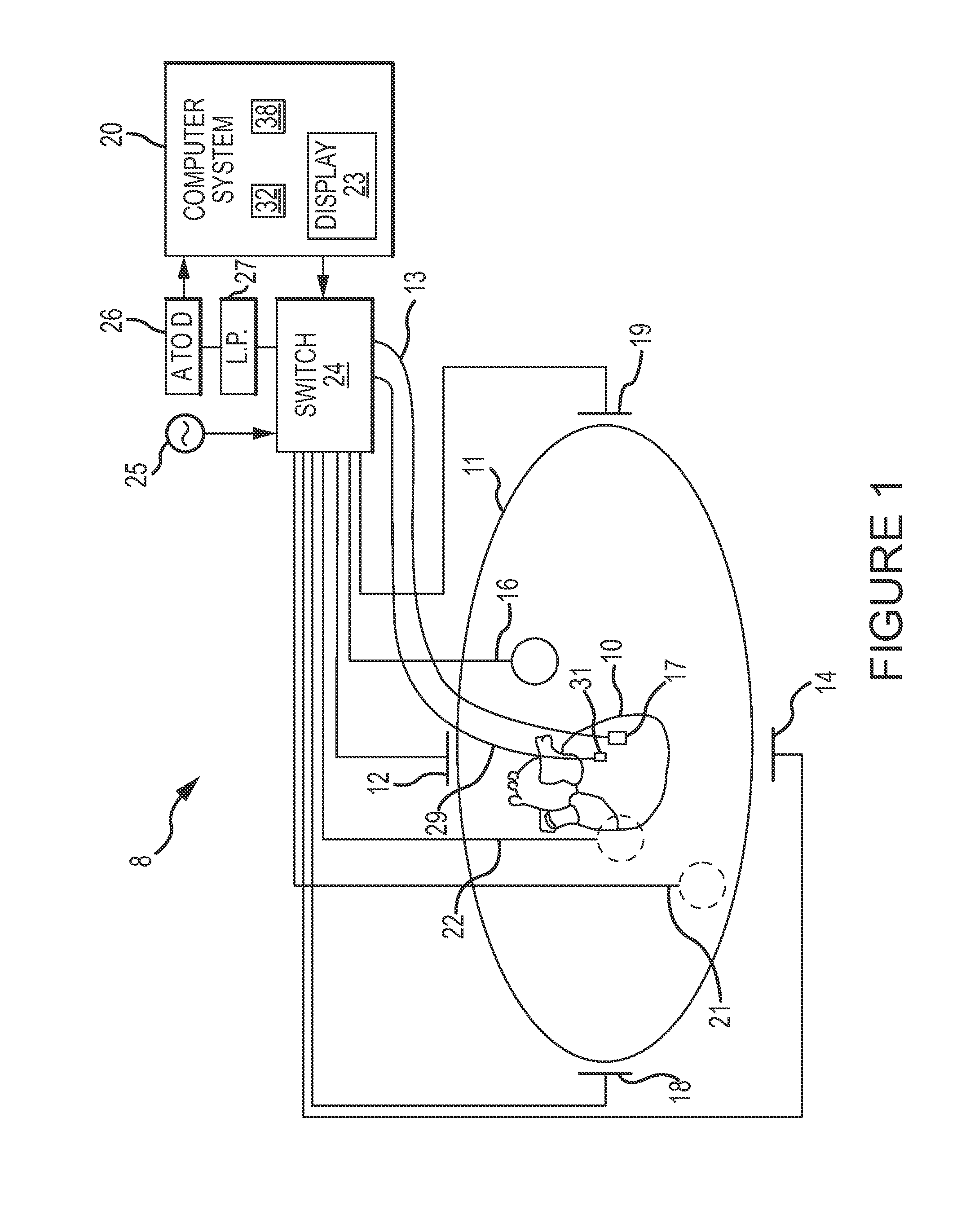 Cardiac Mapping System And Method For Bi-Directional Activation Detection Of Electrograms