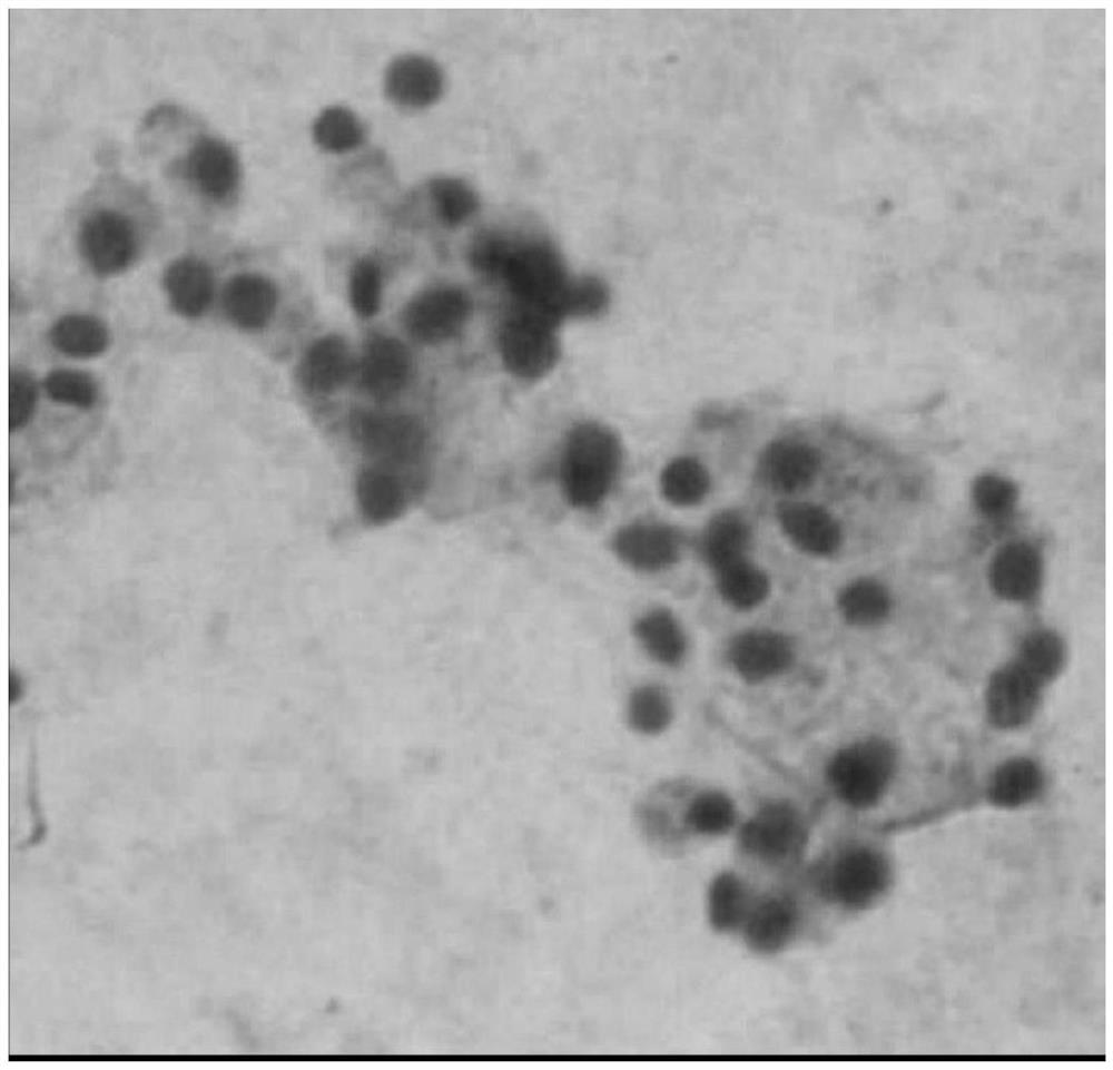 A kind of cell preservation solution for liquid-based cell inspection and its preparation method