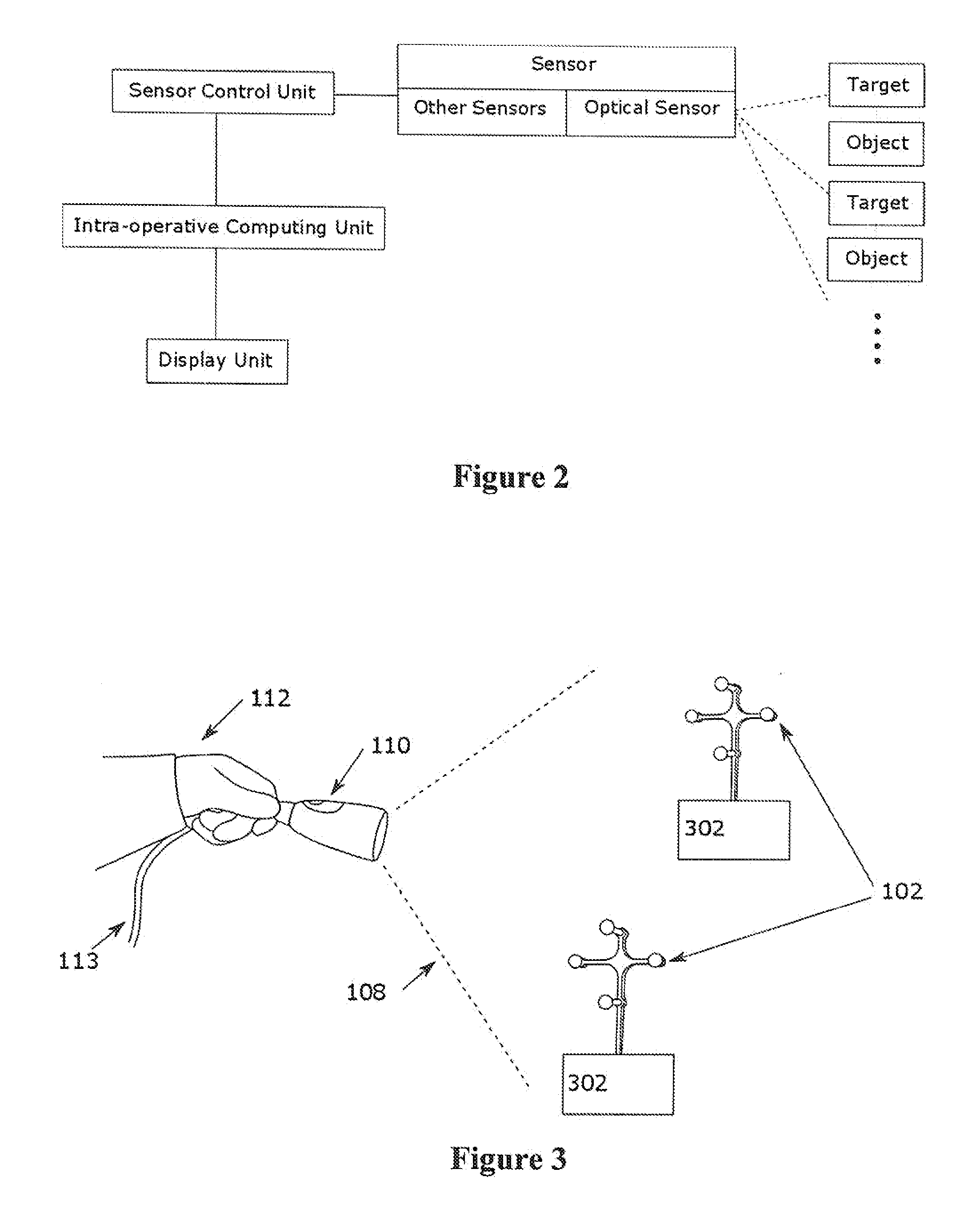 Surgical navigation system with one or more body borne components and method therefor