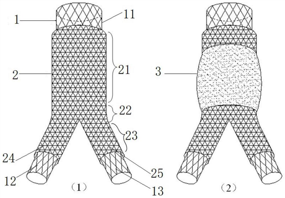 Vascular covered stent with anti-thrombus/anti-tumor function and preparation method thereof