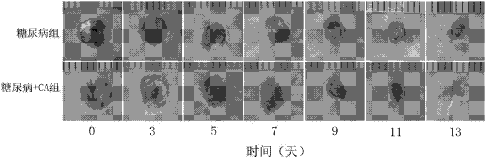 Medicine for treating diabetic ulcer