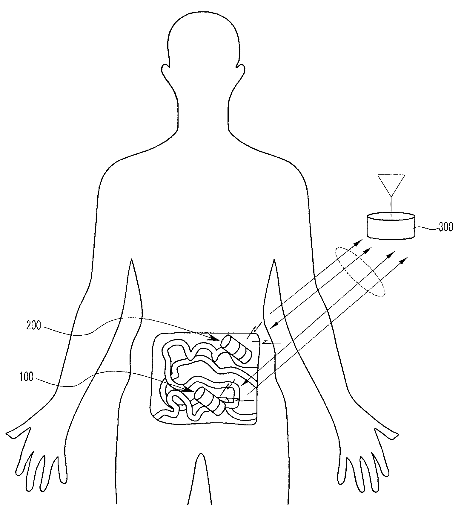 Capsule endoscopy system, medical system, and operation method of medical system