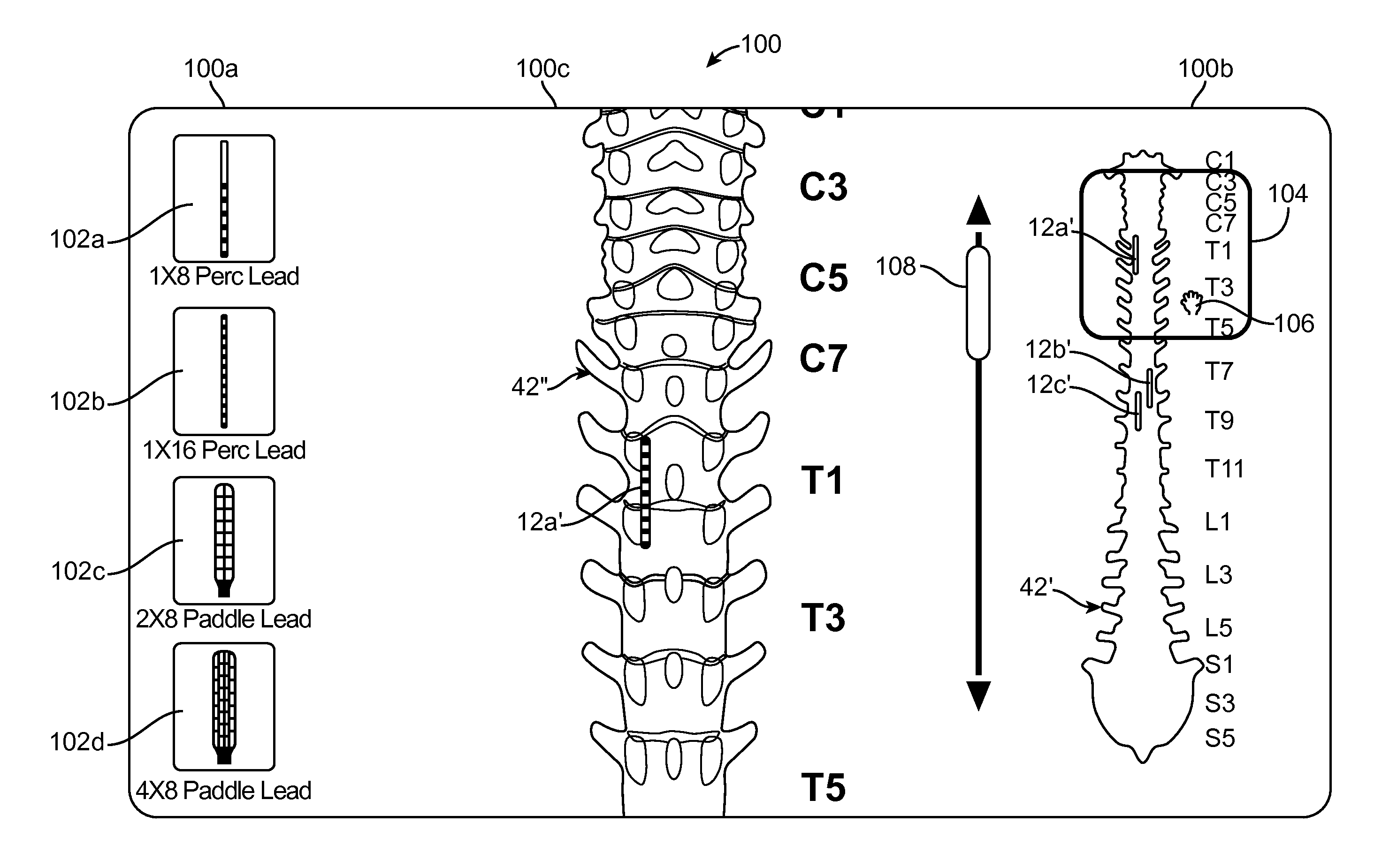 User interface with view finder for localizing anatomical region