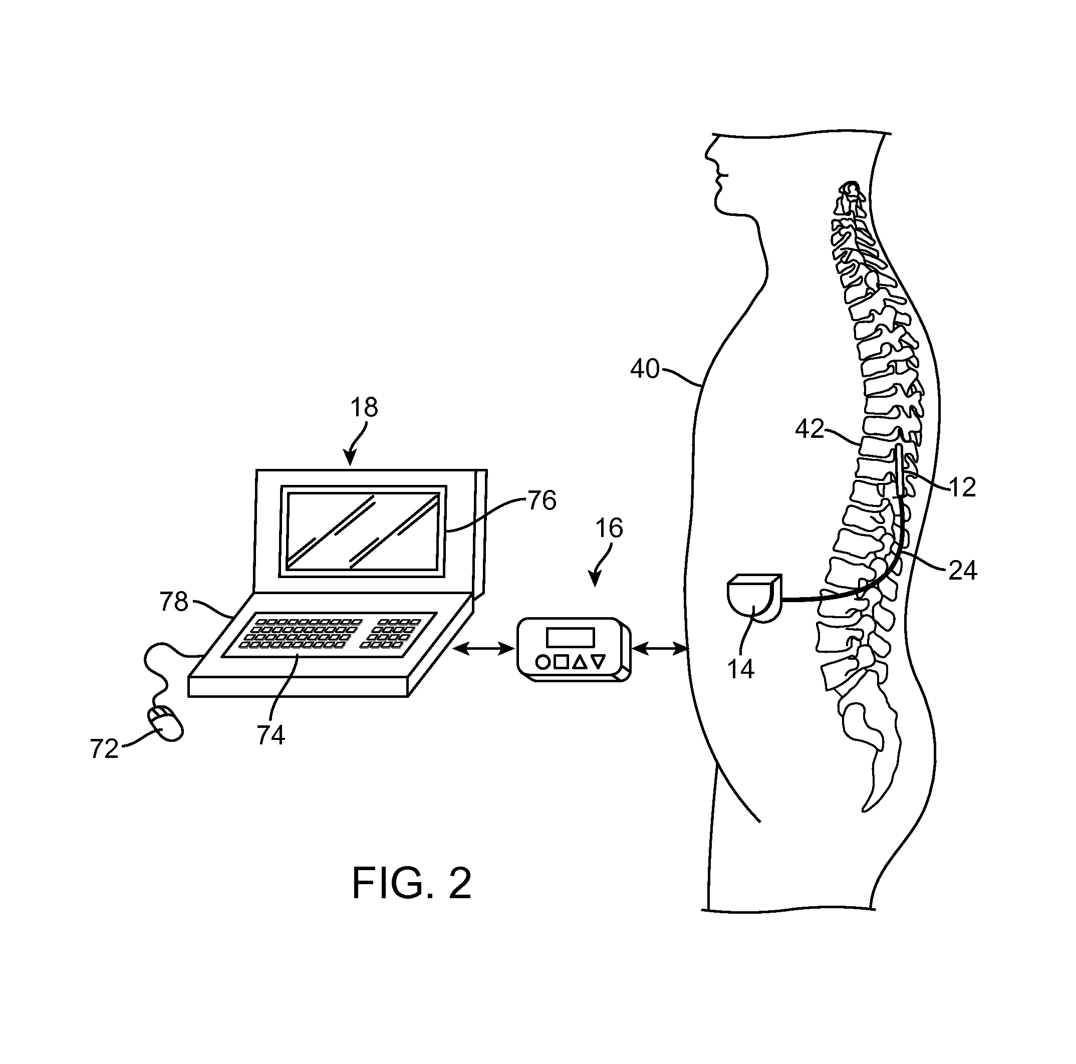 User interface with view finder for localizing anatomical region