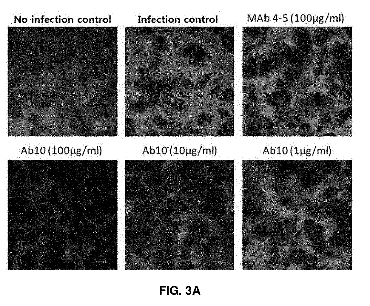 Antibody that binds to envelope glycoprotein of severe fever with thrombocytopenia syndrome virus and use for same