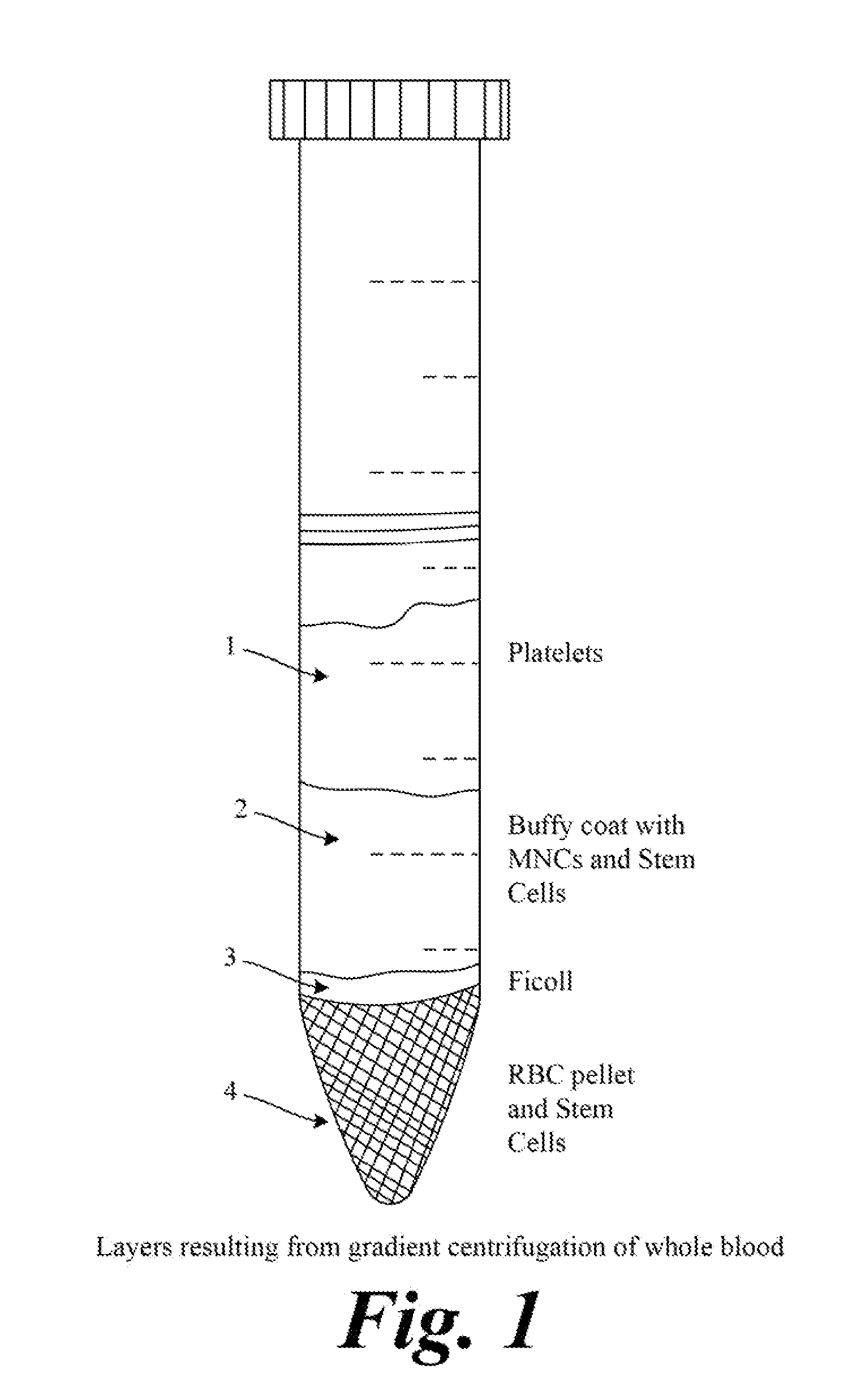 Personalized production of biologics and method for reprogramming somatic cells