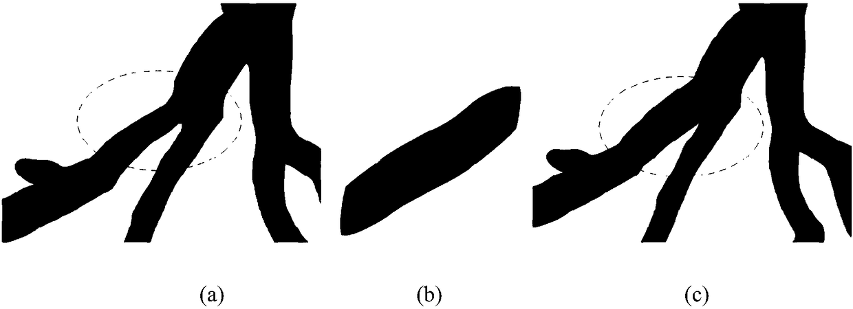 Method for correcting coronary blood vessel models on basis of implicit modeling technologies