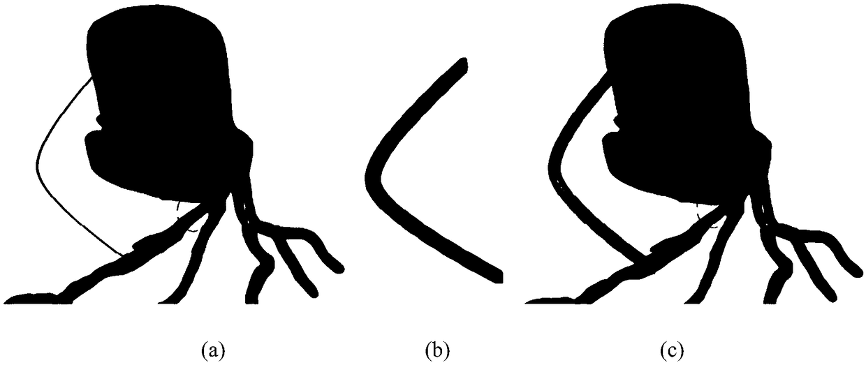 Method for correcting coronary blood vessel models on basis of implicit modeling technologies