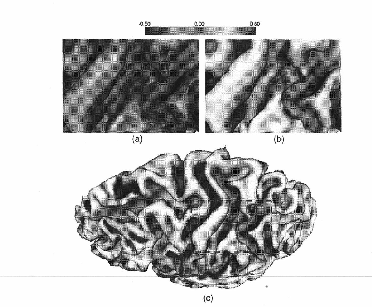 Method for segmenting sulus regions on surface of pallium of a three-dimensional cerebral magnetic resonance image