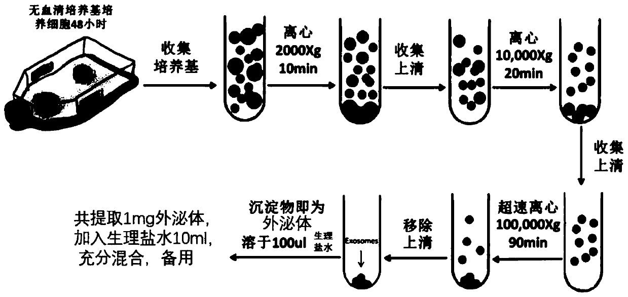 Preparation method of stem cell exosomes and novel application thereof